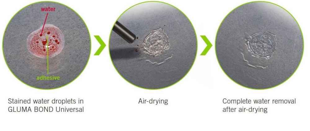 Kulzer Gluma Bond Universal 4 ML