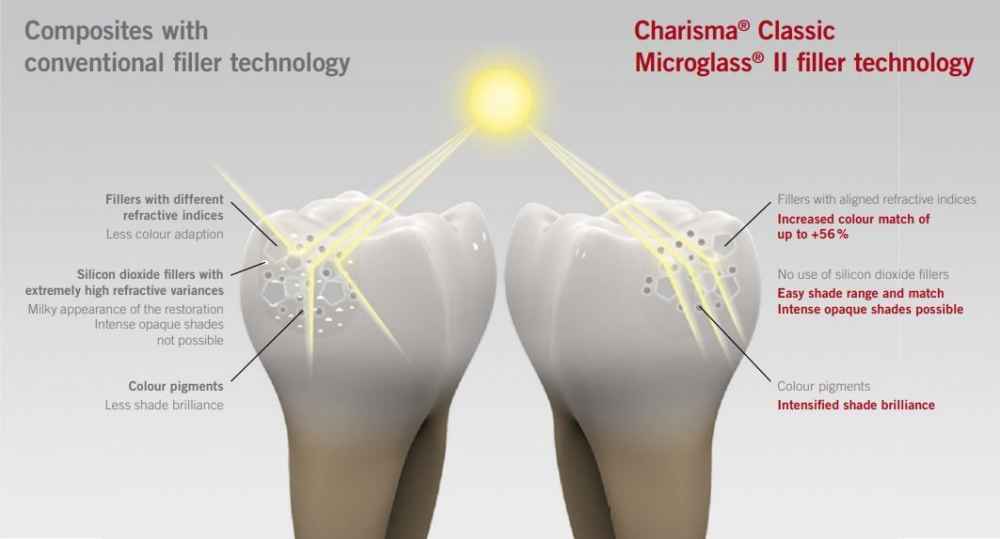 Kulzer Charisma Classic Composite