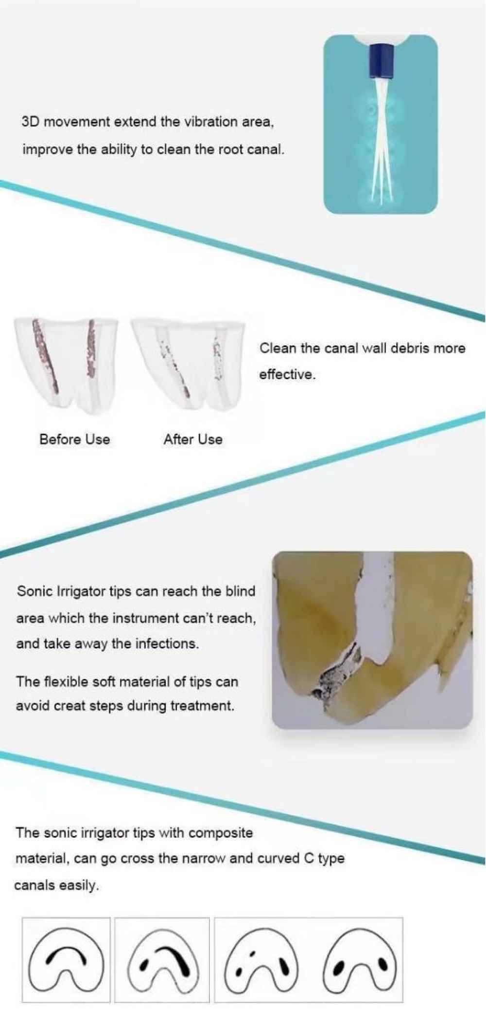 Glin Dental Sonic Endo Irrigator ( 120 Tips )