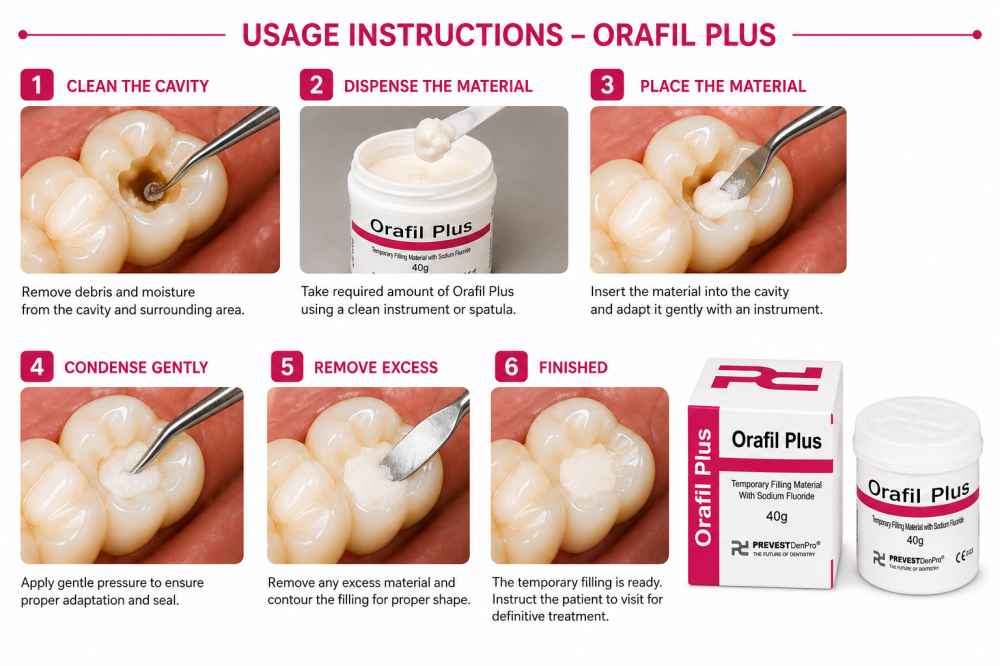 Prevest  Denpro Orafil Plus Temporary Filling Material With Sodium Fluoride 40g