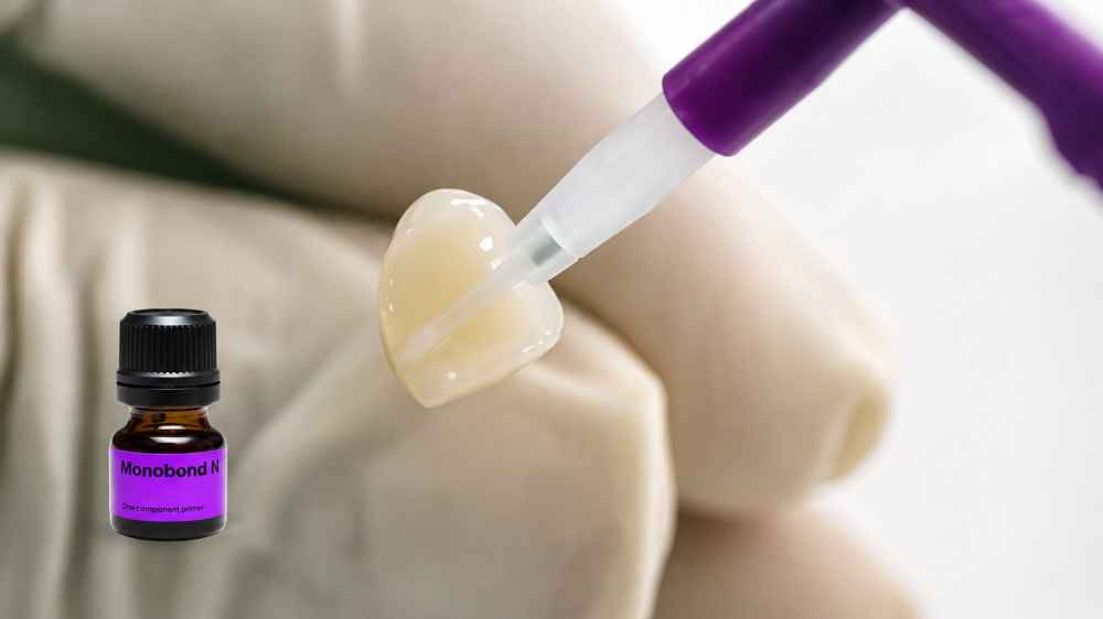 Ivoclar Vivadent Monobond N Primer 5gm
