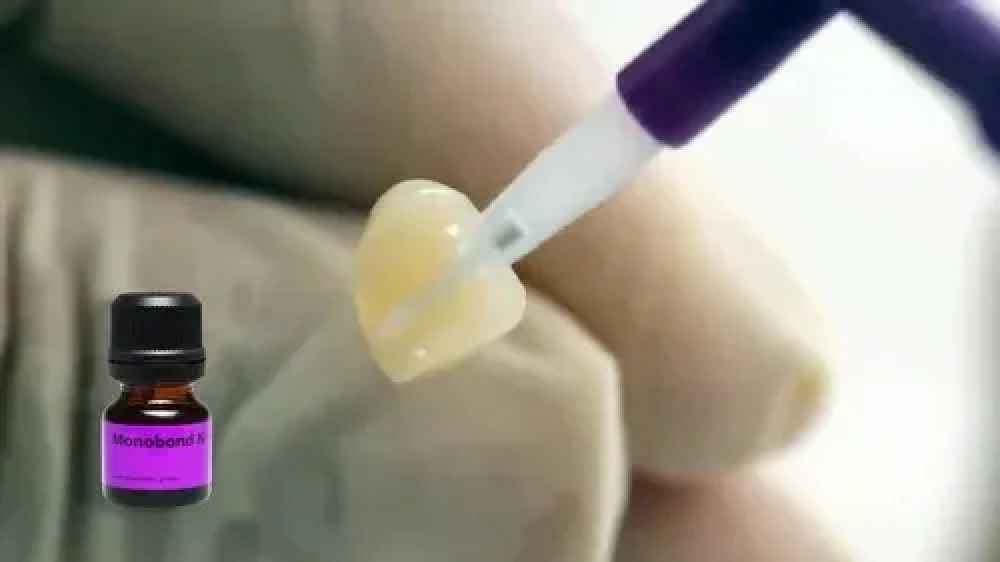 Ivoclar Vivadent Monobond N Primer 5gm