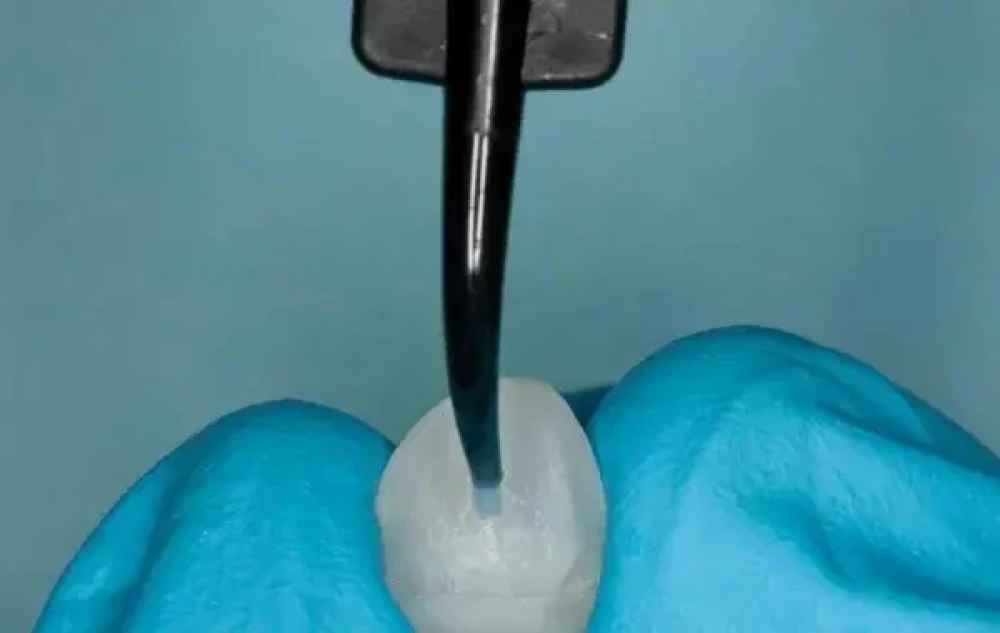 Ultradent Porcelain Silane Refill (410)