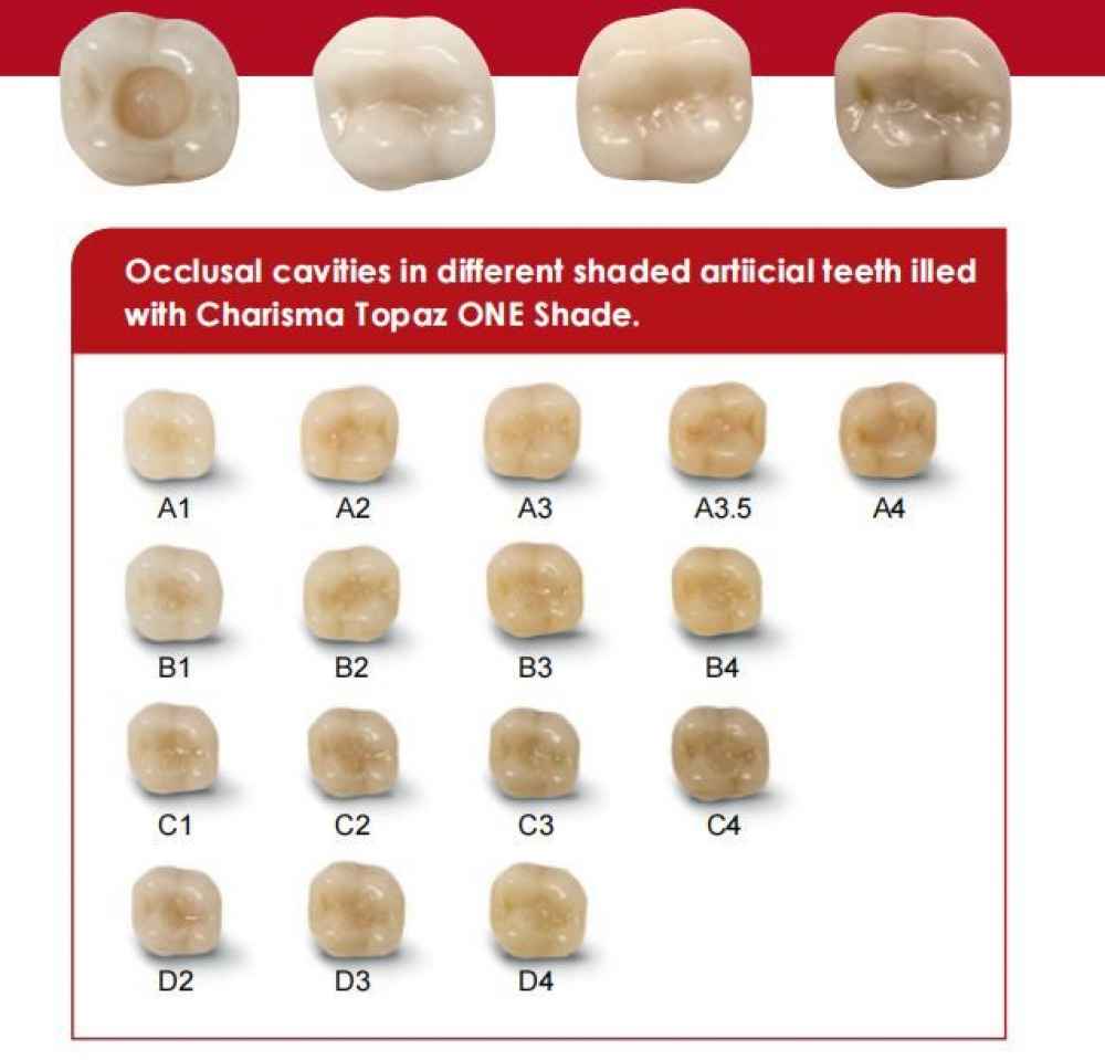 Kulzer Topaz One Shade Resin Based Restorative Composite Kit