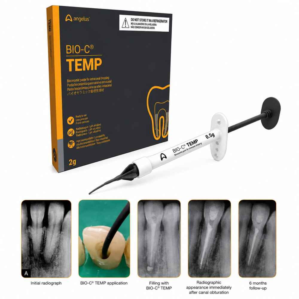 Angelus Bio-C Temp Syringes 0.5gm