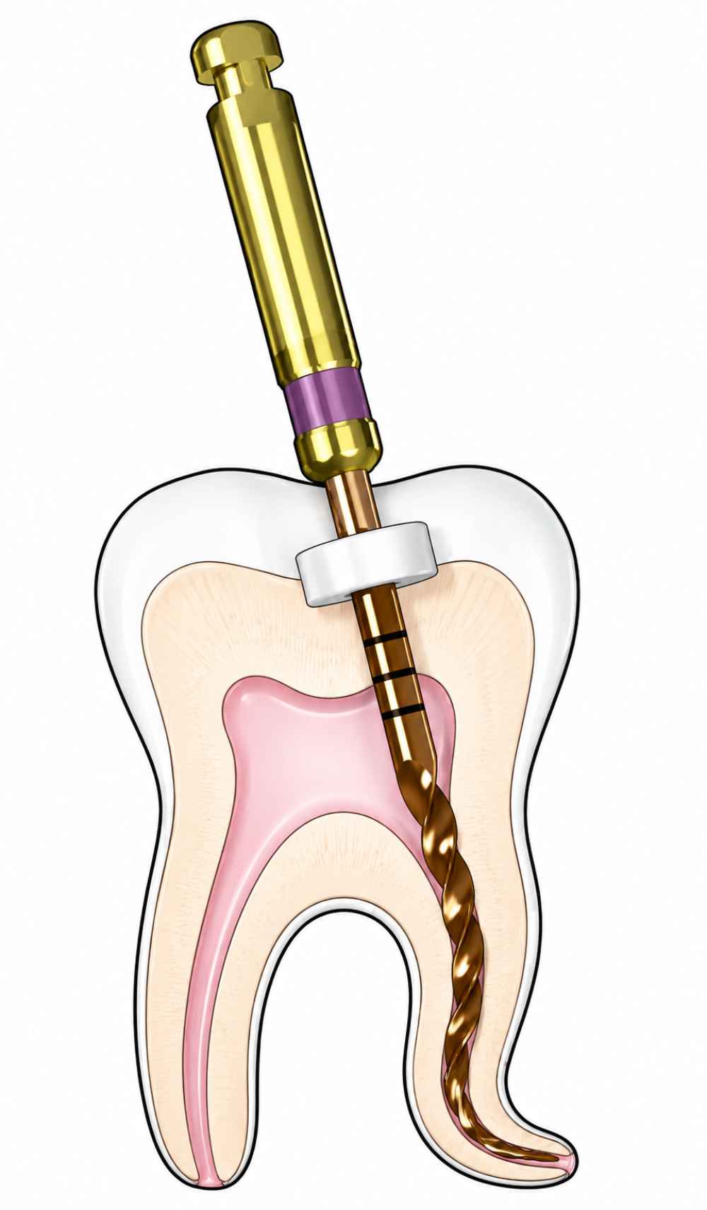 Woodpecker Endo Plus Heat Treated Gold Rotary File