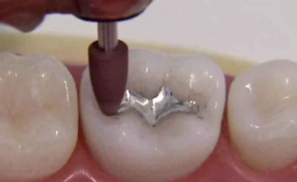 Shofu Amalgam Polishing Kit Fg/Ca