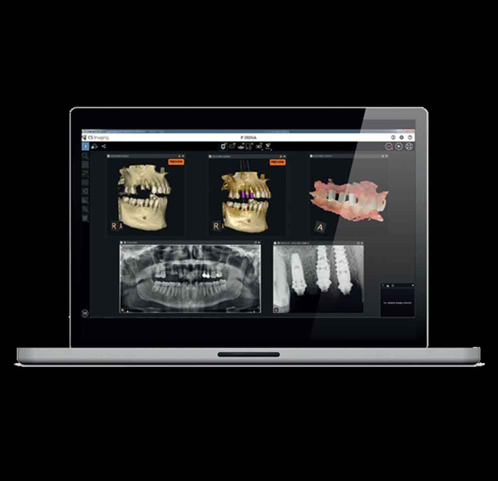 Carestream Dental CS8100 ACCESS OPG