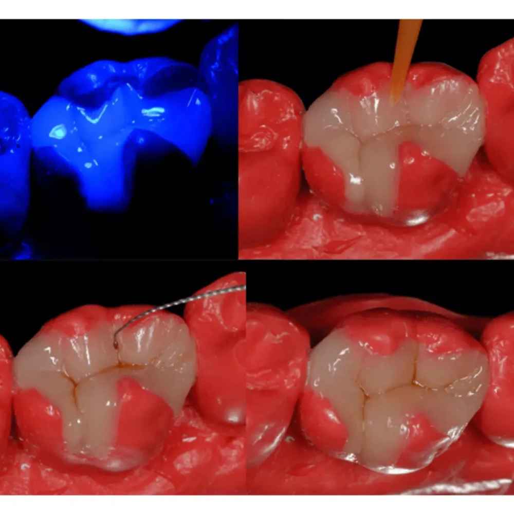 Voco Die Silicone - Cartridge 50 ml