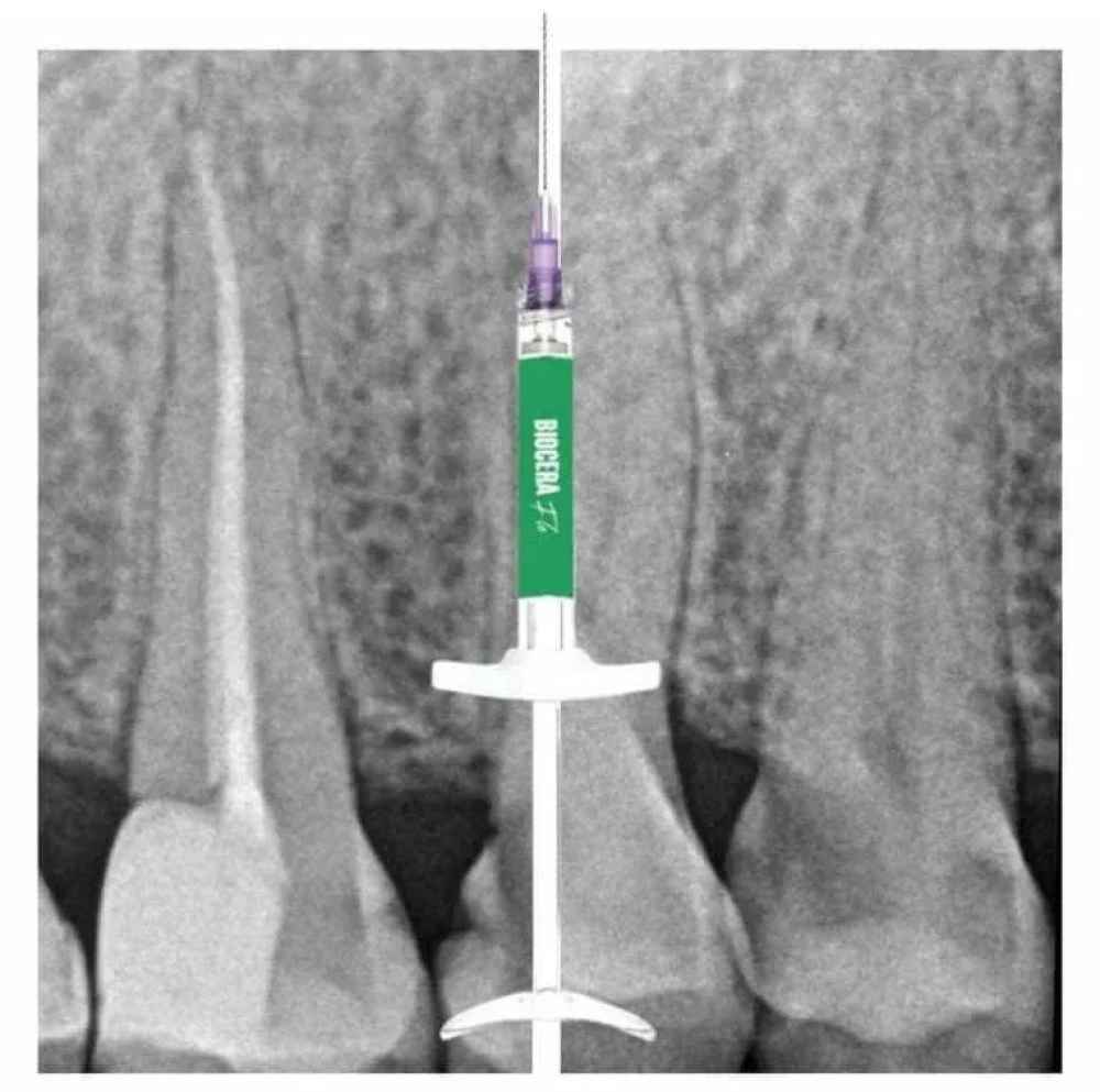 NT Biocera Flo Bioceramic Root Canal Sealer