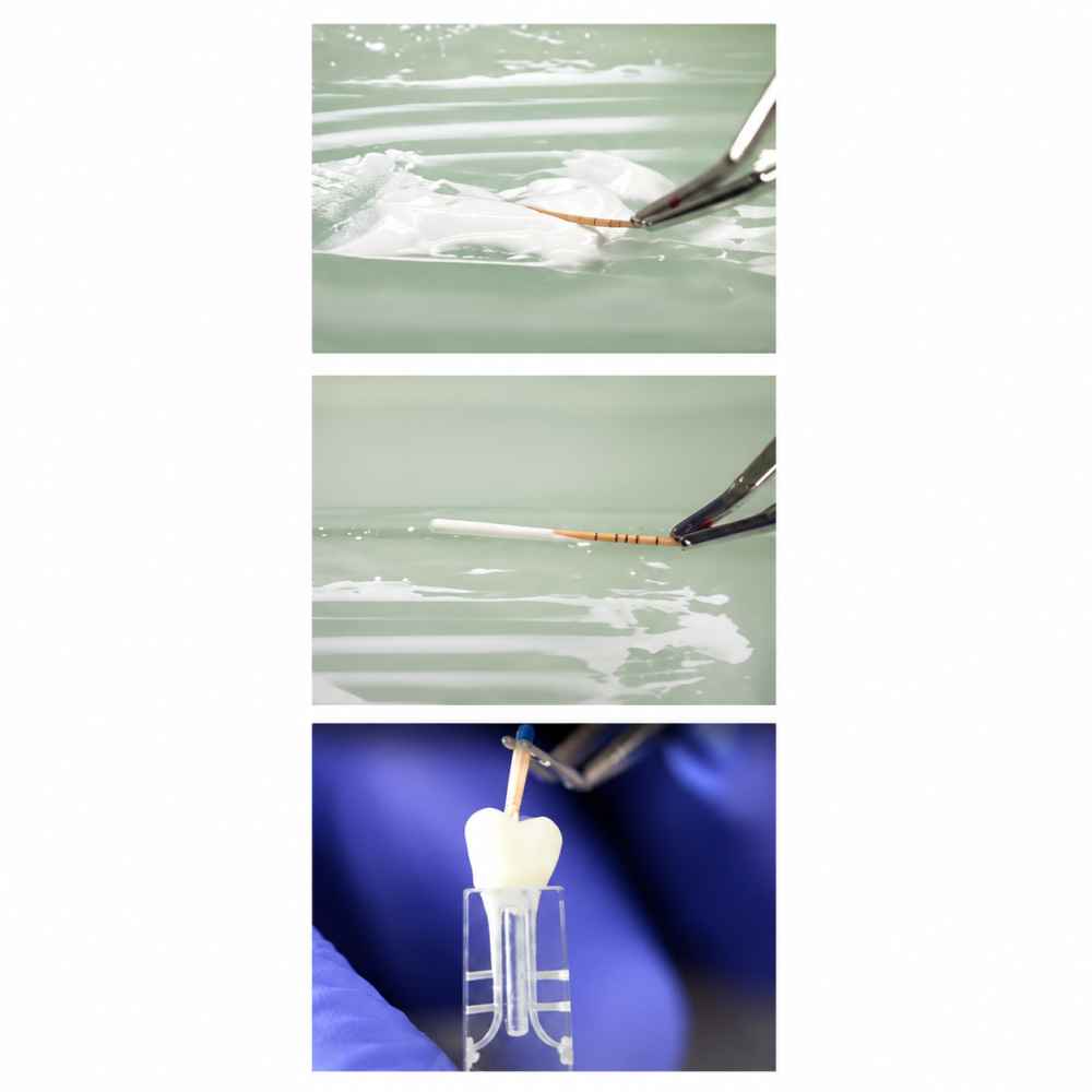 Septodont Bio Root RCS Mineral-based Root Canal Sealer