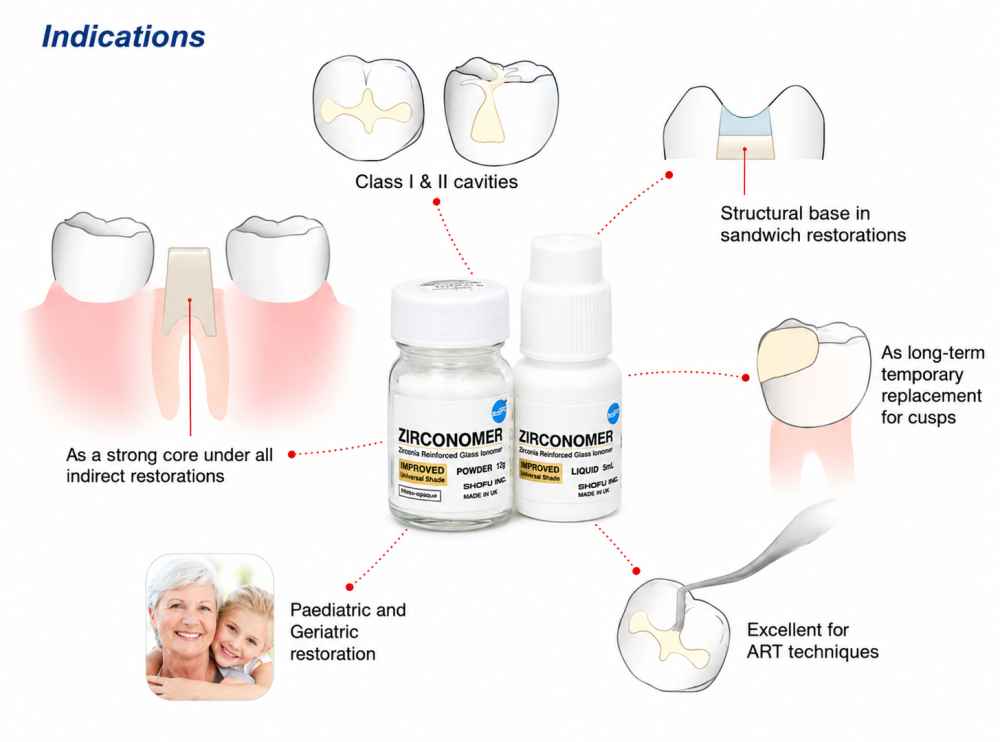 Shofu Zirconomer Improved Reinforced Glass Ionomer