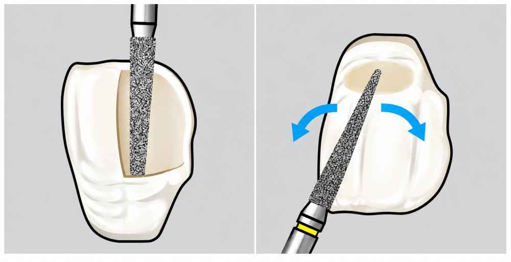 Shofu Direct Cosmetic Restoration Kit