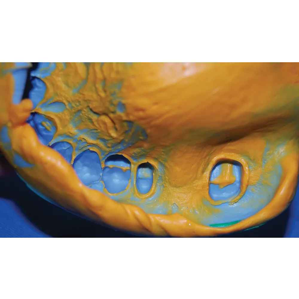 GC Flexceed Putty And Kit