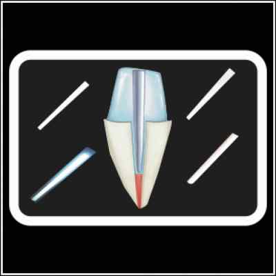 Ammdent Glass Fiber Post Ammdent Glass Fiber Post
