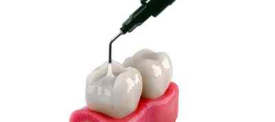 Ammdent Flowable Nano Optimized Light Cure Composite 