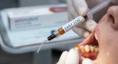 Ammdent Easy Stat Viscous 20% Ferric Sulfate Acid Ammdent Easy Stat Viscous 20% Ferric Sulfate Acid