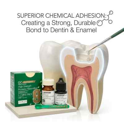 GC Gold Label 9 Posterior Restorative GIC mini pack GC Gold Label 9 Posterior Restorative GIC mini pack