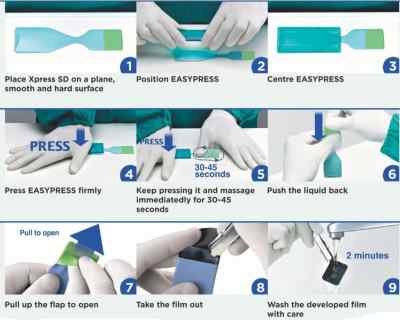 Dental Avenue Xpress SD Self Developing X-Ray Films