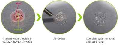 Kulzer Gluma Bond Universal 4 ML Kulzer Gluma Bond Universal 4 ML