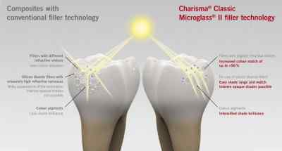 Kulzer Charisma Classic Composite