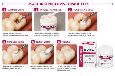 Prevest Denpro Orafil Plus Temporary Filling Material With Sodium Fluoride 40g Prevest Denpro Orafil Plus Temporary Filling Material With Sodium Fluoride 40g