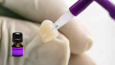 Ivoclar Vivadent Monobond N Primer 5gm Ivoclar Vivadent Monobond N Primer 5gm