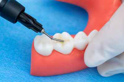 Prevest Fusion I -Seal Light Cure Glass Ionomer Cement . 