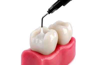 Sdi Wave Flowable Composite A3 Sdi Wave Flowable Composite A3
