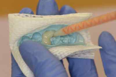 Dentsply Integrity Temporary Crown And Bridge Material Dentsply Integrity Temporary Crown And Bridge Material