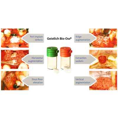 Geistlich Bio-Oss