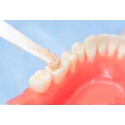 Spident BaGIC ll Glass Ionomer Filling Material Spident BaGIC ll Glass Ionomer Filling Material
