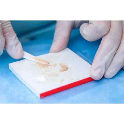 Spident BaGIC ll Glass Ionomer Filling Material Spident BaGIC ll Glass Ionomer Filling Material