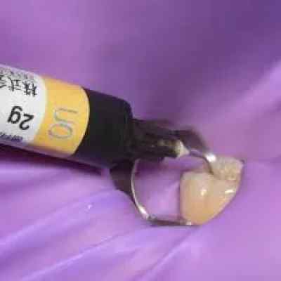 Shofu Beautifil Opaquer