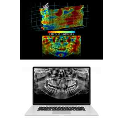 Carestream Dental CS8100 ACCESS OPG