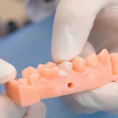 Vincismile TopCEM Dual Cure Resin Cement Vincismile TopCEM Dual Cure Resin Cement