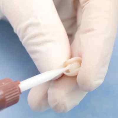 Vincismile TopCEM Dual Cure Resin Cement Vincismile TopCEM Dual Cure Resin Cement