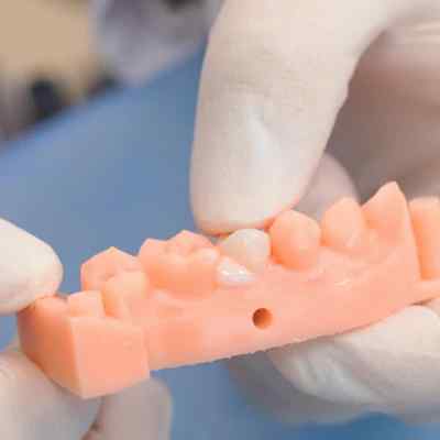 Vincismile TopCEM Dual Cure Resin Cement Vincismile TopCEM Dual Cure Resin Cement