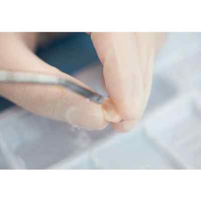 Vincismile HF-Etchant Hydrofluoric Acid Etching Gel Vincismile HF-Etchant Hydrofluoric Acid Etching Gel