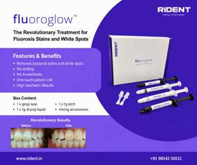 Rident Fluoroglow carries infiltrant Kit Rident Fluoroglow carries infiltrant Kit
