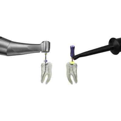Dentsply X-Smart Pro Plus Endomotor with Integrated Apex Locator