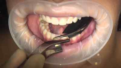 Bausch Dental Articulating Papers with Progressive Colour Transfer - 200µ Microns Bausch Dental Articulating Papers with Progressive Colour Transfer - 200µ Microns