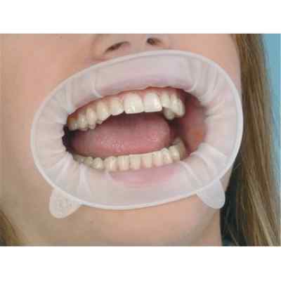 Ivoclar Optragate Cheek And Lip Retractor Ivoclar Optragate Cheek And Lip Retractor