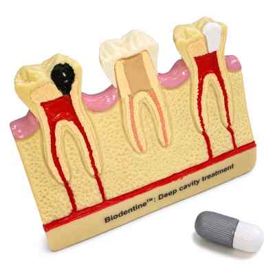 Septodont Biodentine Kit ( Pack of 5 capsules )