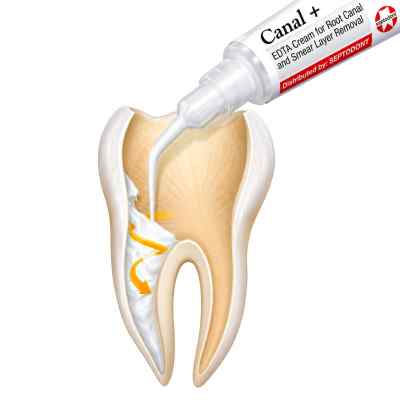 Septodont Canal + EDTA Gel Septodont Canal + EDTA Gel