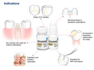 Shofu Zirconomer Improved Reinforced Glass Ionomer Shofu Zirconomer Improved Reinforced Glass Ionomer