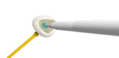 Shofu AZ Primer Primer for bonfing alumina or zirconia