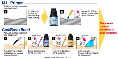Shofu P & R Repair Kit Light-Cure Bonding System